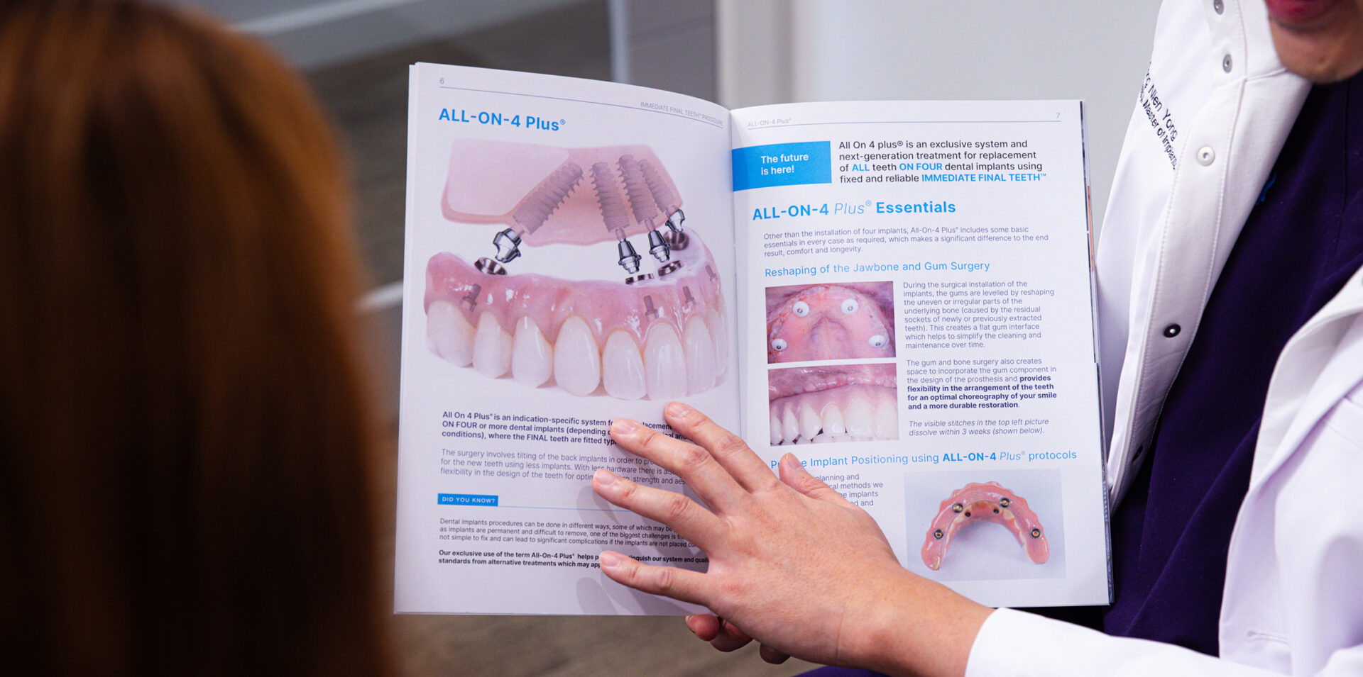 All-On-4 Plus® Melton Full Arch Dental Implants Permanent Teeth