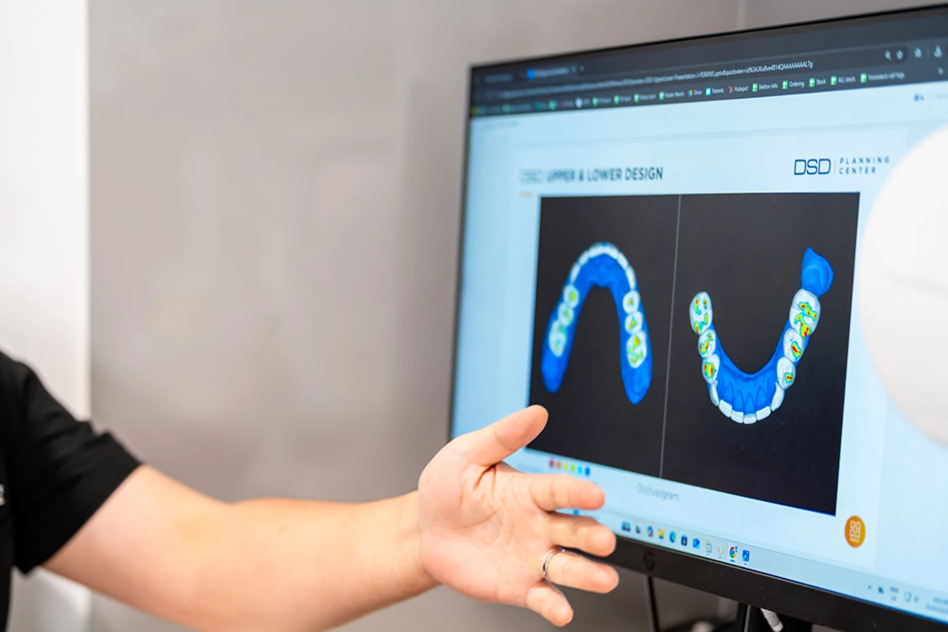 Digital Smile Design