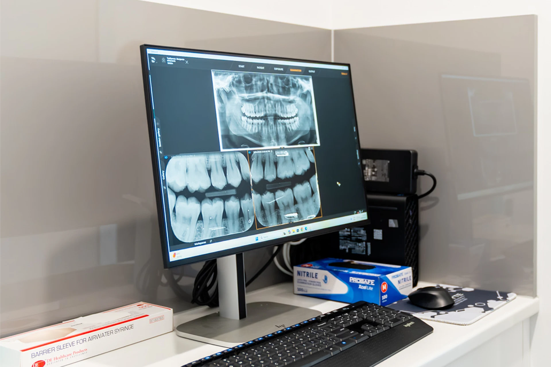 Digital X-Rays